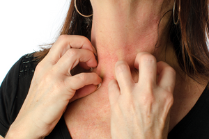 Алергія на срібні прикраси: чи варто боятися людям із чутливою шкірою?